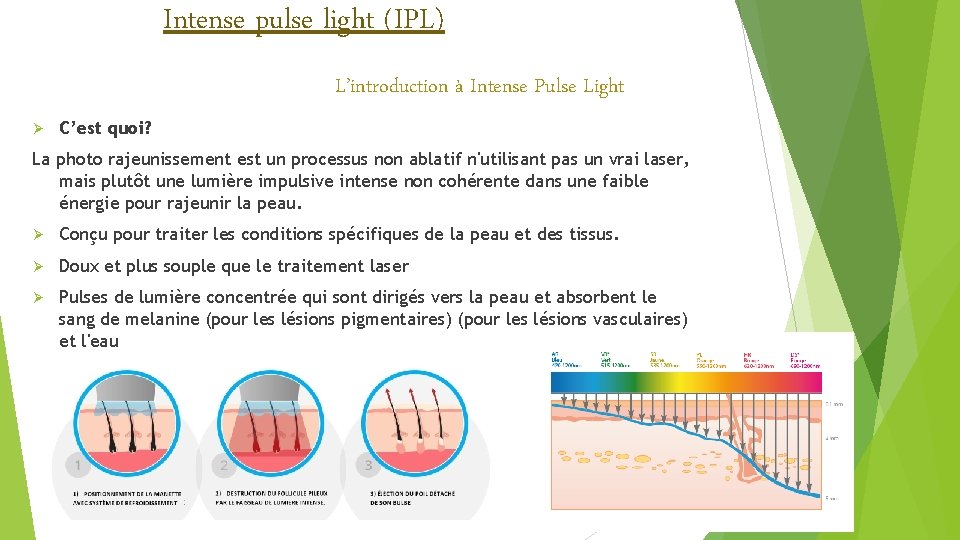 Intense pulse light (IPL) L’introduction à Intense Pulse Light Ø C’est quoi? La photo Intense pulse light (IPL) L’introduction à Intense Pulse Light Ø C’est quoi? La photo
