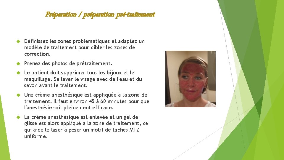Préparation / préparation pré-traitement Définissez les zones problématiques et adaptez un modèle de traitement Préparation / préparation pré-traitement Définissez les zones problématiques et adaptez un modèle de traitement