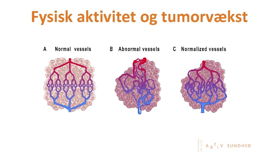 Fysisk aktivitet og tumorvækst 