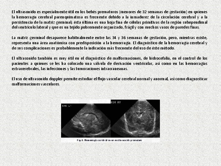 El ultrasonido es especialmente útil en los bebés prematuros (menores de 32 semanas de