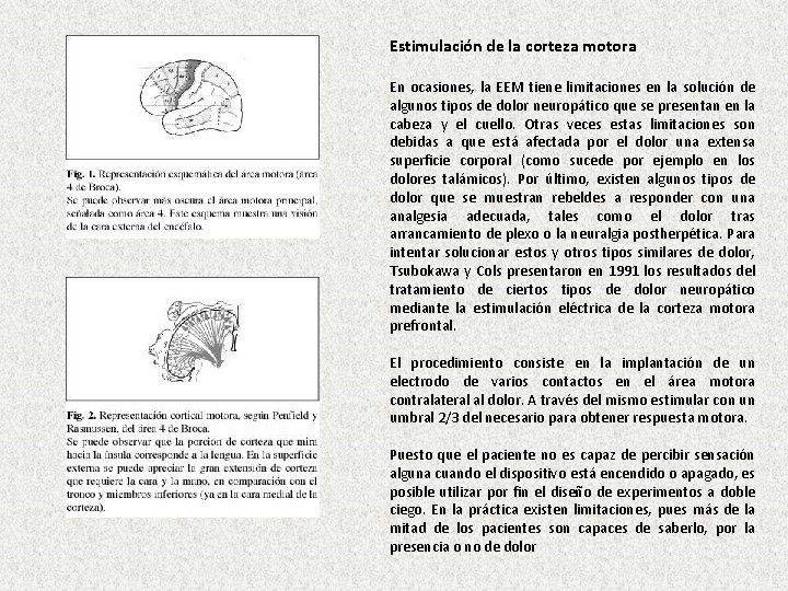 Estimulación de la corteza motora En ocasiones, la EEM tiene limitaciones en la solución