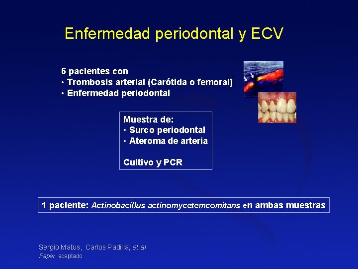 Enfermedad periodontal y ECV 6 pacientes con • Trombosis arterial (Carótida o femoral) • Enfermedad periodontal y ECV 6 pacientes con • Trombosis arterial (Carótida o femoral) •