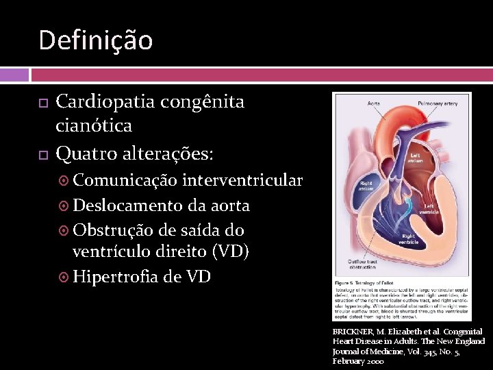 Definição Cardiopatia congênita cianótica Quatro alterações: Comunicação interventricular Deslocamento da aorta Obstrução de saída
