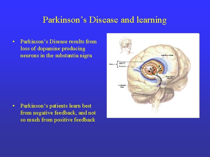 Parkinson’s Disease and learning • Parkinson’s Disease results from loss of dopamine producing neurons