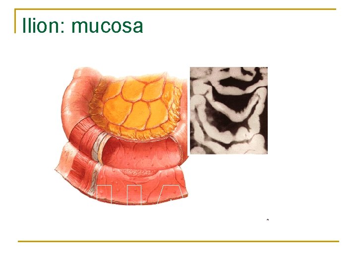 Ilion: mucosa 