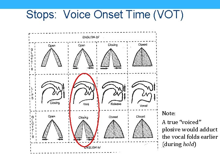 Stops: Voice Onset Time (VOT) Note: A true “voiced” plosive would adduct the vocal