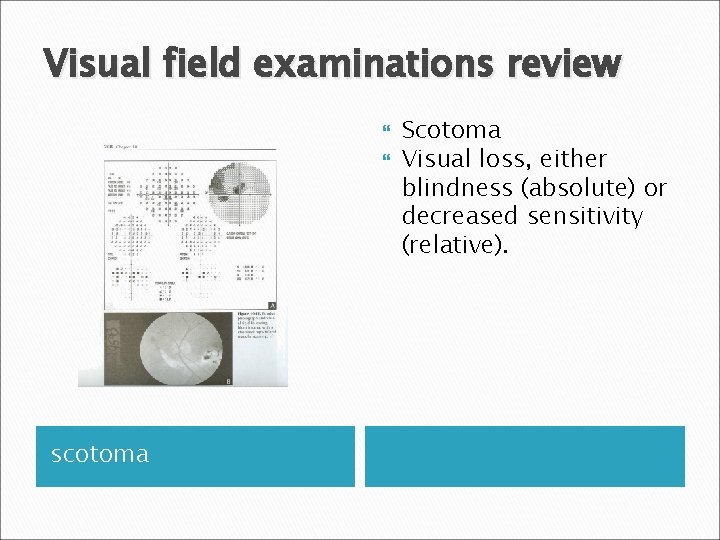 Visual field examinations review scotoma Scotoma Visual loss, either blindness (absolute) or decreased sensitivity