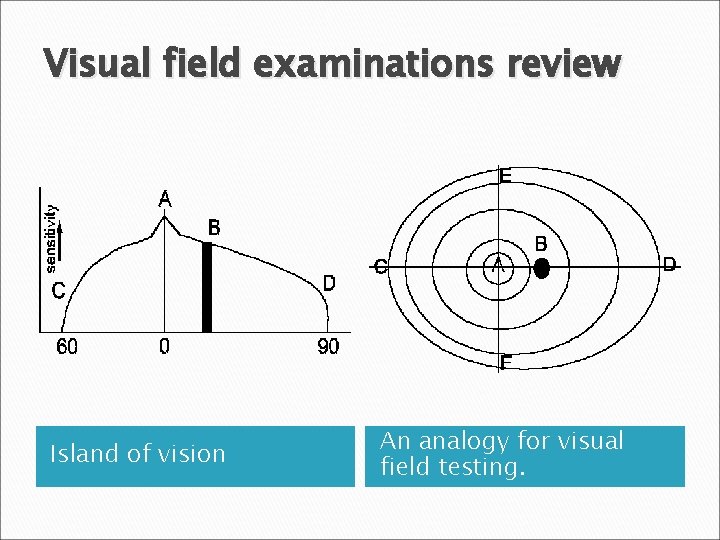 Visual field examinations review Island of vision An analogy for visual field testing. 