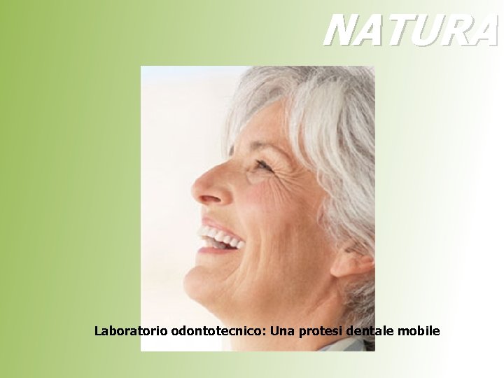 NATURA Laboratorio odontotecnico: Una protesi dentale mobile 