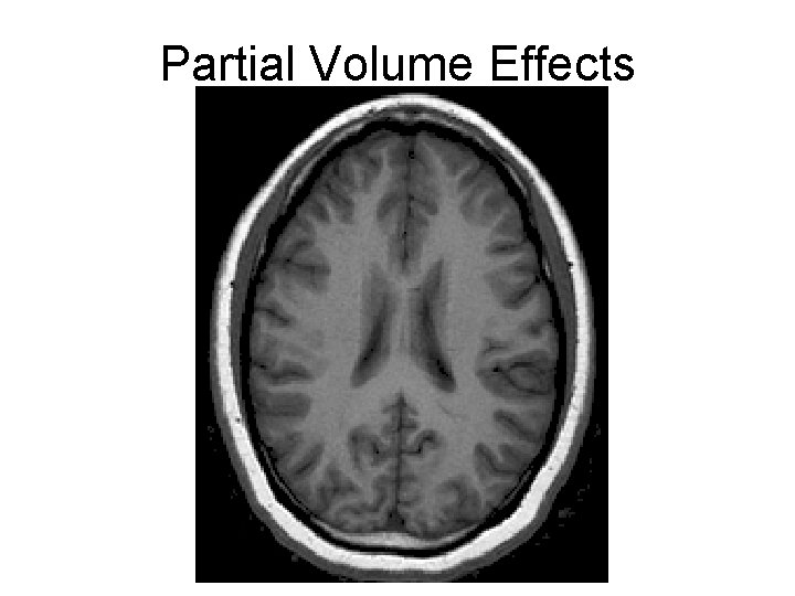 Partial Volume Effects 