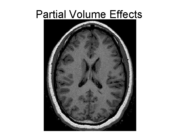 Partial Volume Effects 