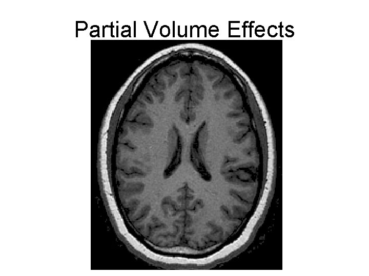 Partial Volume Effects 