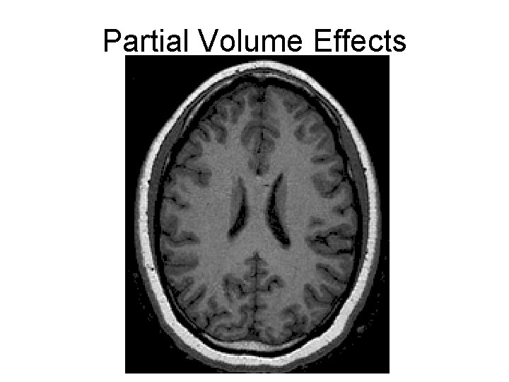 Partial Volume Effects 