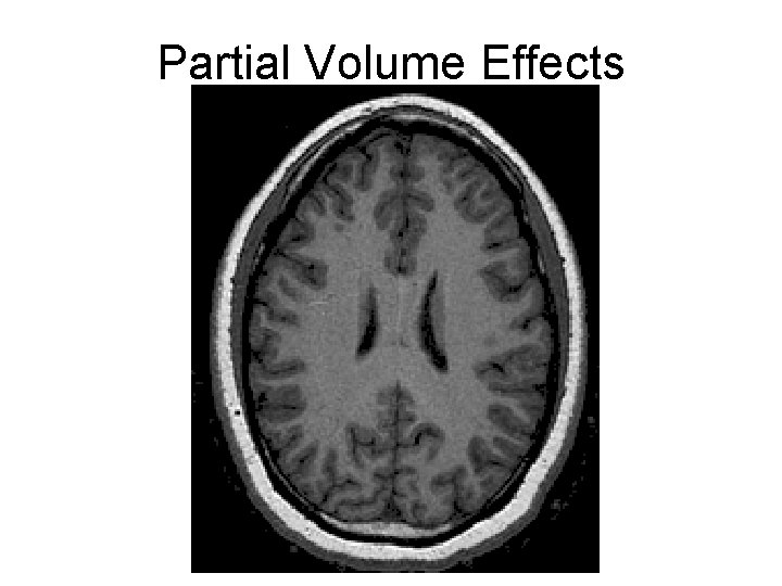 Partial Volume Effects 