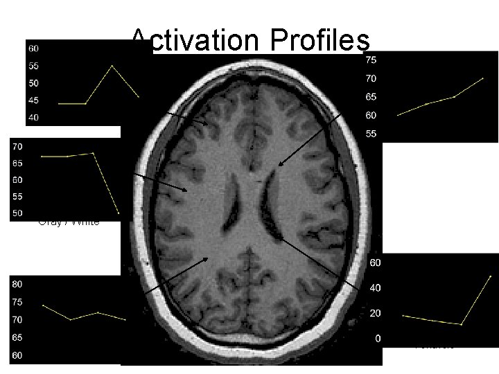 Activation Profiles Gray / White Ventricle Gray / White Matter Ventricle 