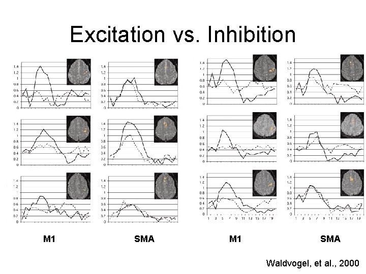 Excitation vs. Inhibition M 1 SMA Waldvogel, et al. , 2000 