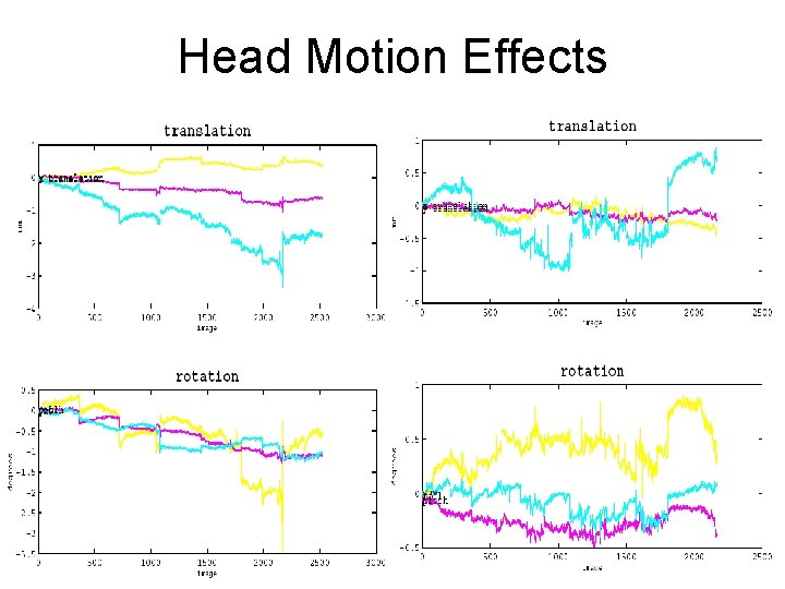 Head Motion Effects 