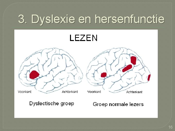 3. Dyslexie en hersenfunctie 16 