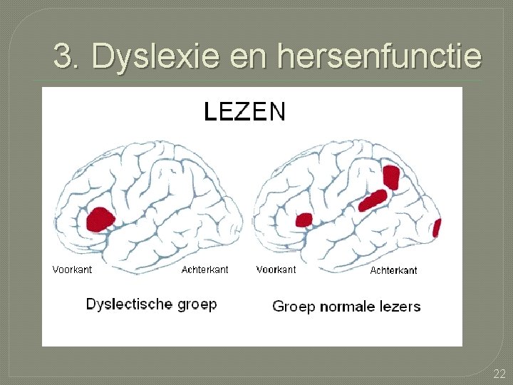 3. Dyslexie en hersenfunctie 22 