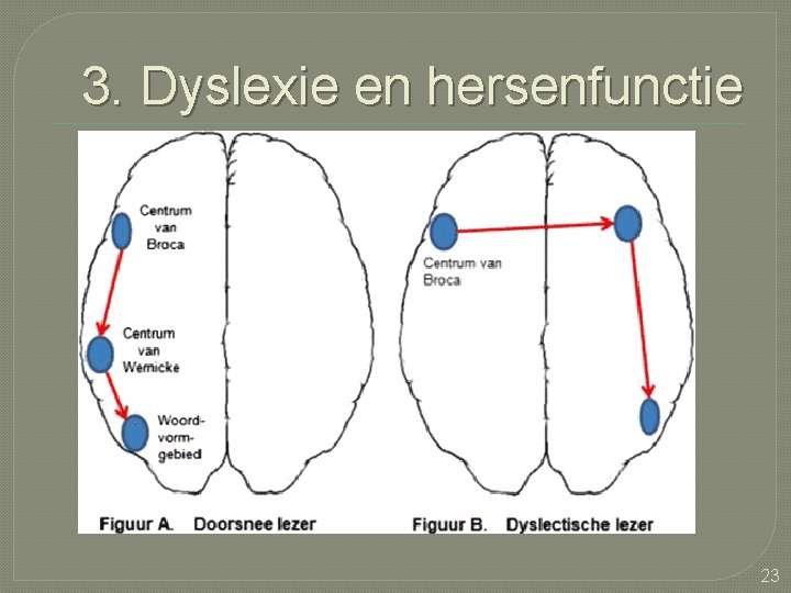 3. Dyslexie en hersenfunctie 23 