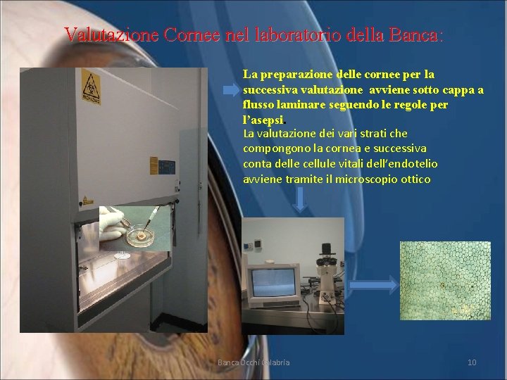 Valutazione Cornee nel laboratorio della Banca: La preparazione delle cornee per la successiva valutazione
