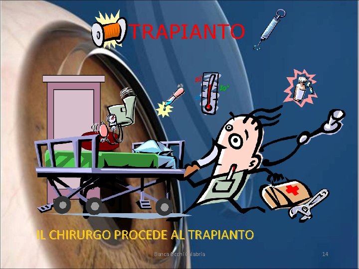 TRAPIANTO IL CHIRURGO PROCEDE AL TRAPIANTO Banca Occhi Calabria 14 