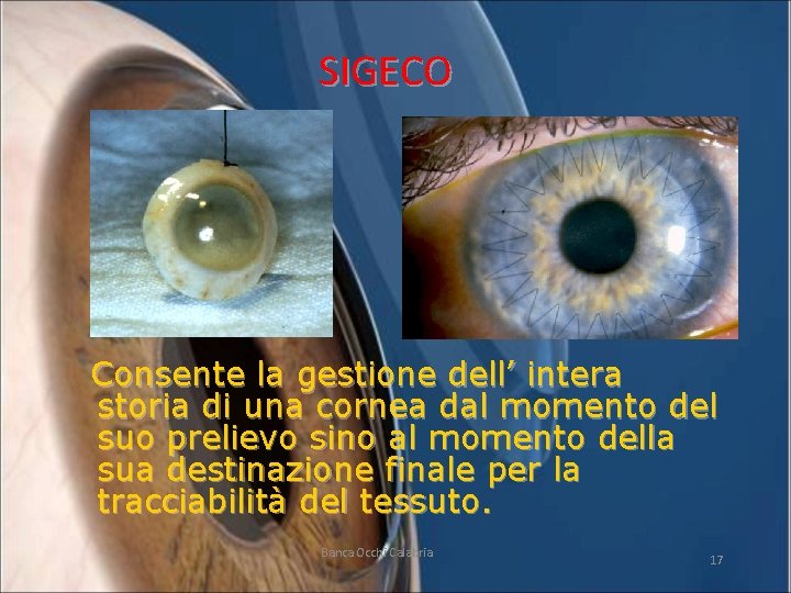 SIGECO Consente la gestione dell’ intera storia di una cornea dal momento del suo