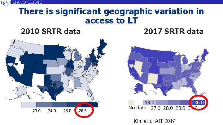 MAYO CLINIC There is significant geographic variation in access to LT 2010 SRTR data MAYO CLINIC There is significant geographic variation in access to LT 2010 SRTR data