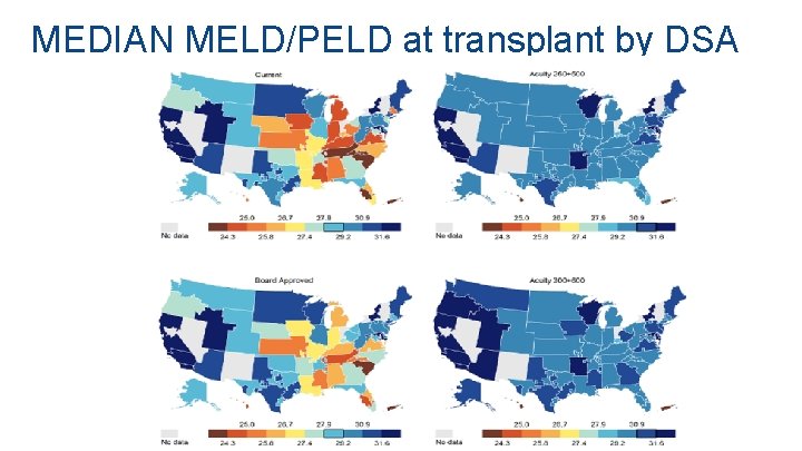 MEDIAN MELD/PELD at transplant by DSA MEDIAN MELD/PELD at transplant by DSA