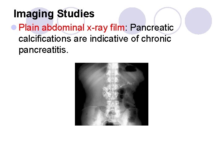Imaging Studies l Plain abdominal x-ray film: Pancreatic calcifications are indicative of chronic pancreatitis.