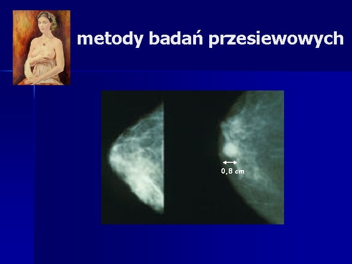 metody badań przesiewowych 0, 8 cm 