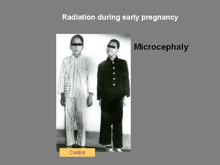 Radiation during early pregnancy Microcephaly Control 