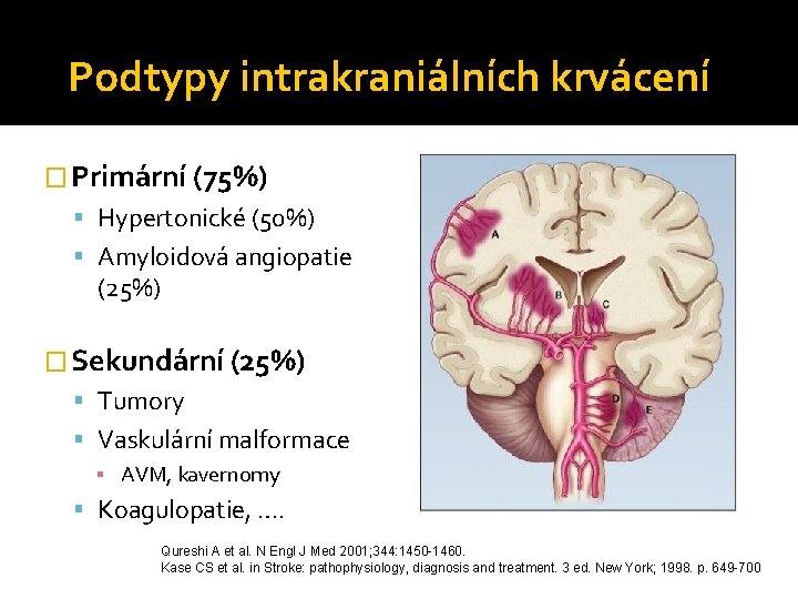 Podtypy intrakraniálních krvácení � Primární (75%) Hypertonické (50%) Amyloidová angiopatie (25%) � Sekundární (25%)