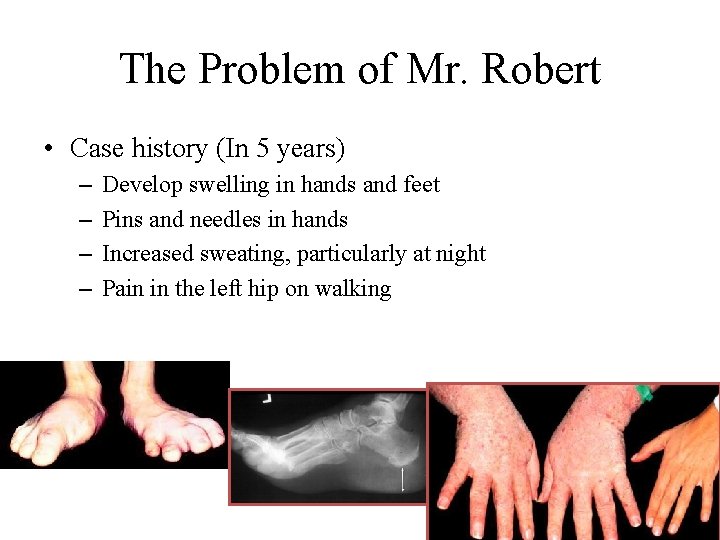 The Problem of Mr. Robert • Case history (In 5 years) – – Develop The Problem of Mr. Robert • Case history (In 5 years) – – Develop
