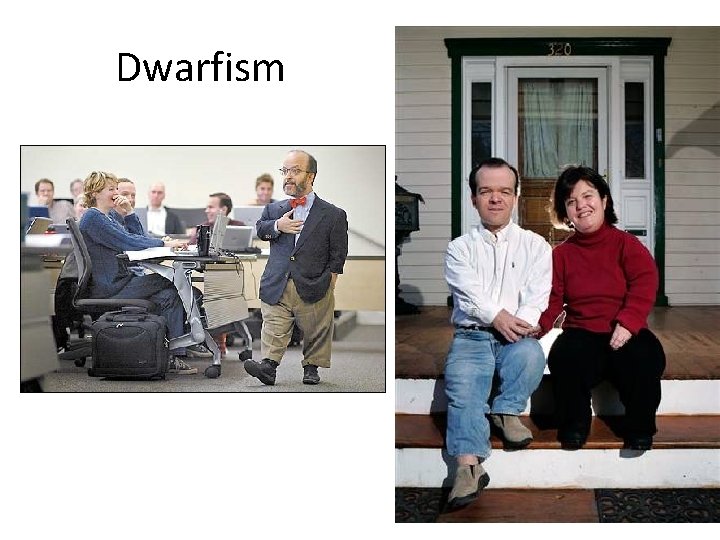 Dwarfism Dwarfism