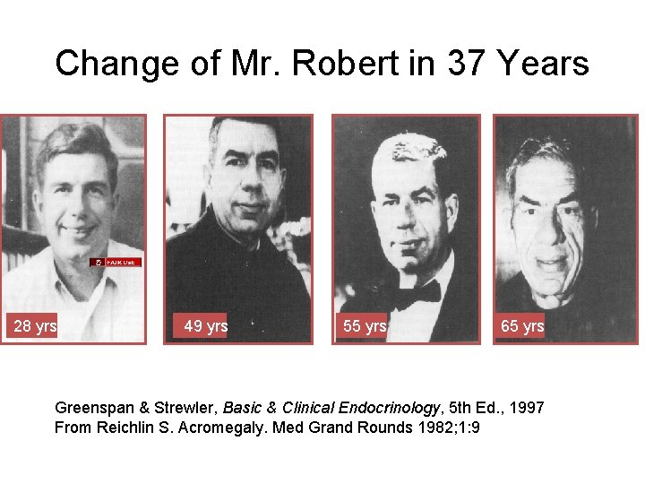 Change of Mr. Robert in 37 Years 28 yrs 49 yrs 55 yrs 65 Change of Mr. Robert in 37 Years 28 yrs 49 yrs 55 yrs 65