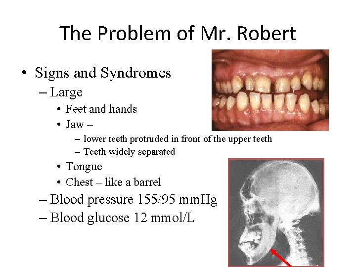 The Problem of Mr. Robert • Signs and Syndromes – Large • Feet and The Problem of Mr. Robert • Signs and Syndromes – Large • Feet and
