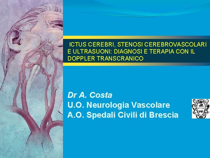 ICTUS CEREBRI, STENOSI CEREBROVASCOLARI E ULTRASUONI: DIAGNOSI E TERAPIA CON IL DOPPLER TRANSCRANICO Dr