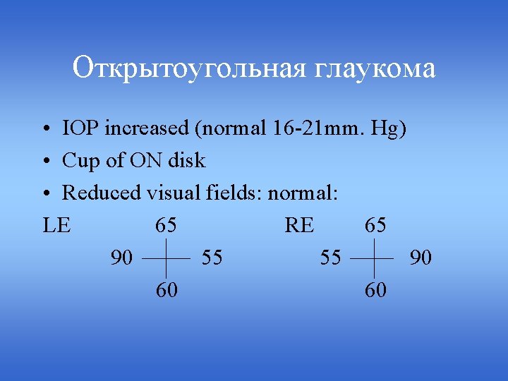 Открытоугольная глаукома • IOP increased (normal 16 -21 mm. Hg) • Cup of ON