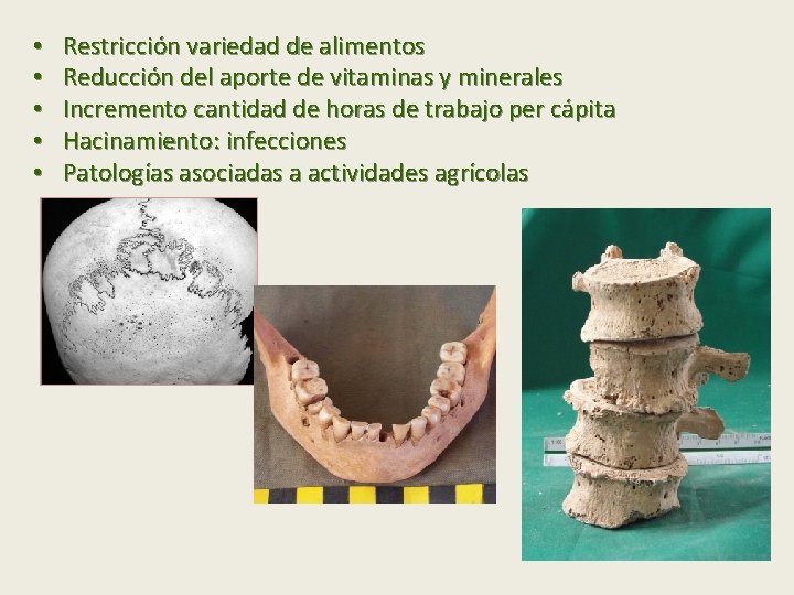  • • • Restricción variedad de alimentos Reducción del aporte de vitaminas y