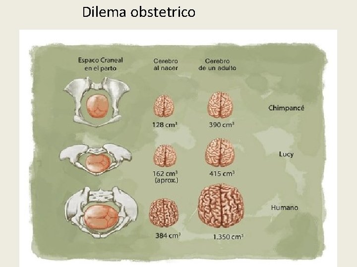 Dilema obstetrico 