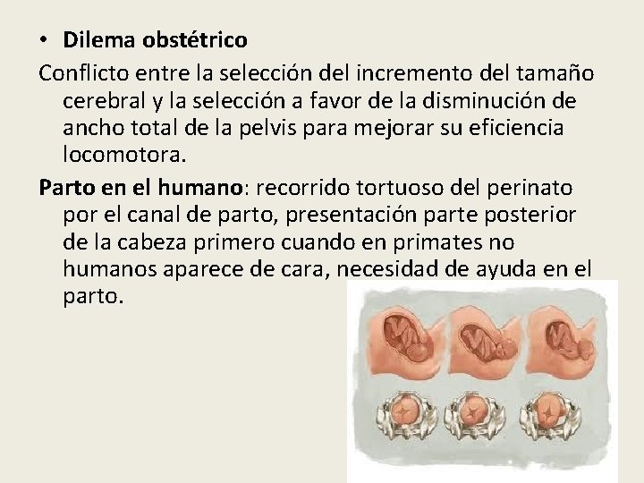  • Dilema obstétrico Conflicto entre la selección del incremento del tamaño cerebral y