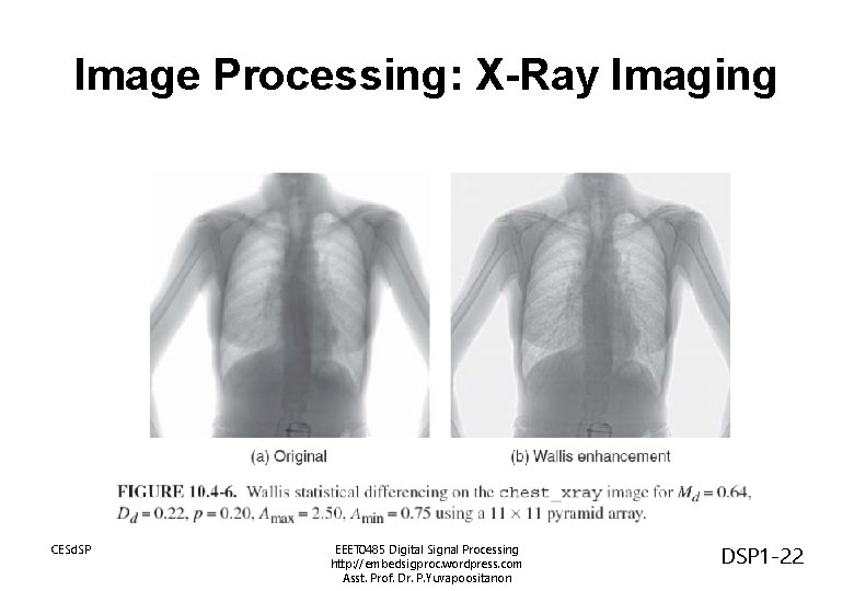 Image Processing: X-Ray Imaging CESd. SP EEET 0485 Digital Signal Processing http: //embedsigproc. wordpress.