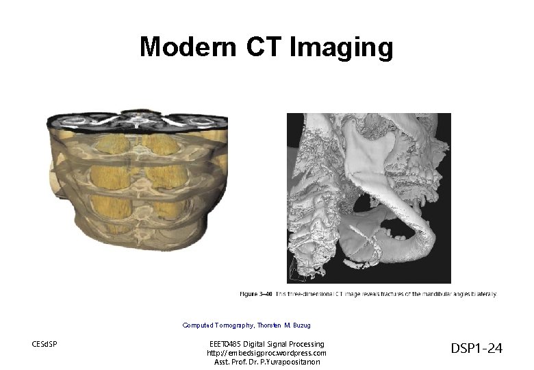 Modern CT Imaging Computed Tomography, Thorsten M. Buzug CESd. SP EEET 0485 Digital Signal