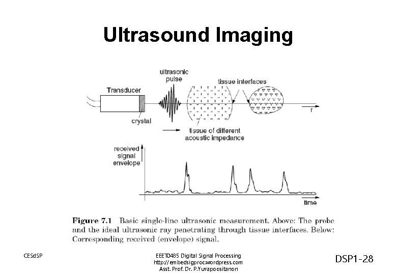 Ultrasound Imaging CESd. SP EEET 0485 Digital Signal Processing http: //embedsigproc. wordpress. com Asst.