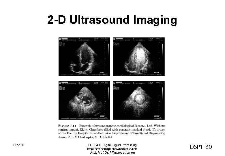 2 -D Ultrasound Imaging CESd. SP EEET 0485 Digital Signal Processing http: //embedsigproc. wordpress.