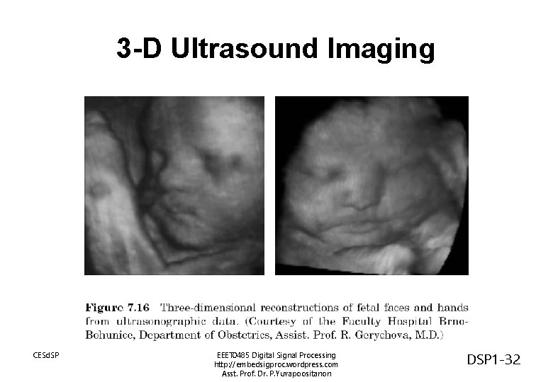 3 -D Ultrasound Imaging CESd. SP EEET 0485 Digital Signal Processing http: //embedsigproc. wordpress.