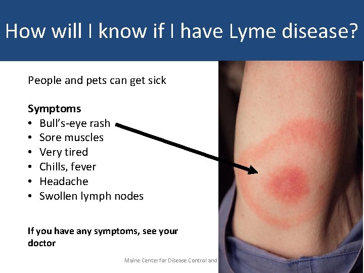 How will I know if I have Lyme disease? People and pets can get