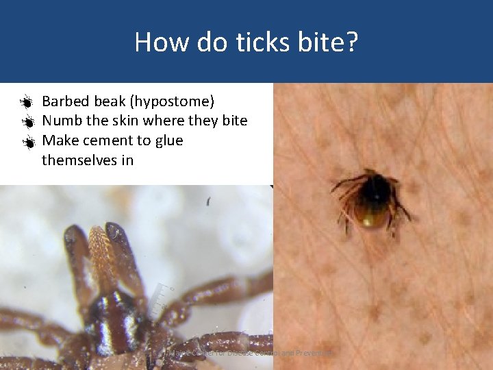 How do ticks bite? Barbed beak (hypostome) Numb the skin where they bite Make