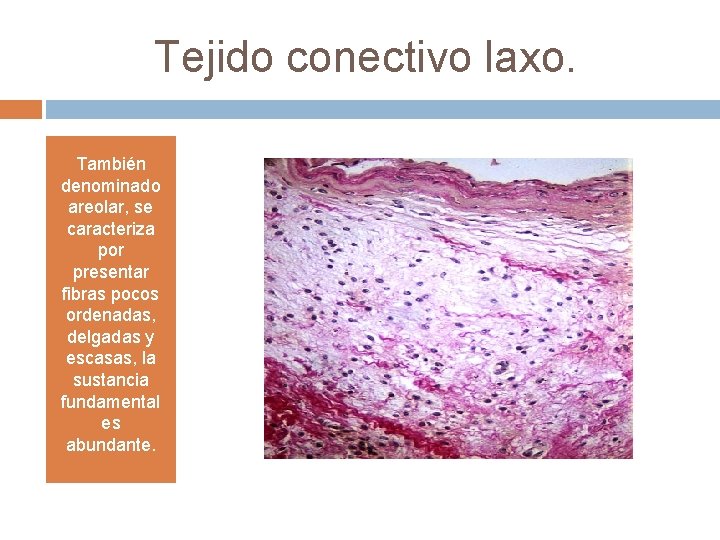 Tejido conectivo laxo. También denominado areolar, se caracteriza por presentar fibras pocos ordenadas, delgadas